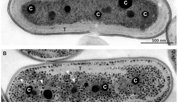 Electron micrographs of Synechococcus Electron micrographs of Synechococcus